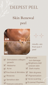 Skin renewal peel